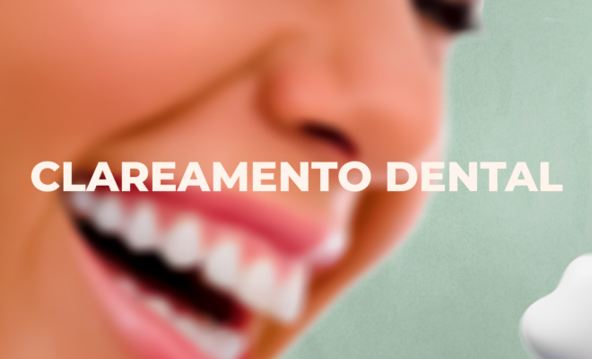 Clareamento Dental